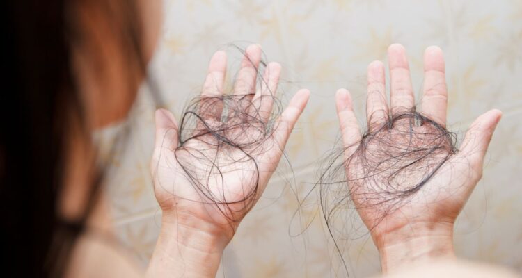 Rambut Rontok